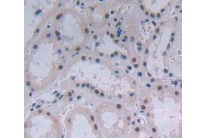 IHC-P analysis of Human Tissue, with DAB staining. (ATF3 抗体  (AA 1-181))