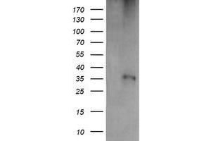 Western Blotting (WB) image for anti-T-cell surface glycoprotein CD1c (CD1C) antibody (ABIN1497187) (CD1c 抗体)