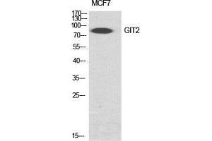 Western Blot (WB) analysis of specific cells using GIT2 Polyclonal Antibody. (GIT2 抗体  (Internal Region))