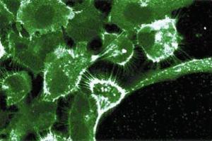 Immunofluroescent staining on A431 cells. (EGFR 抗体  (AA 1020-1046))