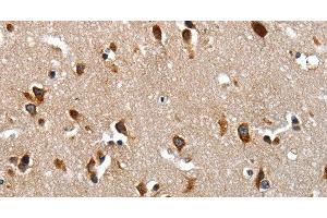 Immunohistochemistry of paraffin-embedded Human brain tissue using LAMA1 Polyclonal Antibody at dilution of 1:70 (Laminin alpha 1 抗体)