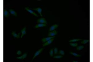 Detection of CASP9 in Human HepG2 cell using Polyclonal Antibody to Caspase 9 (CASP9) (Caspase 9 抗体  (AA 331-416))