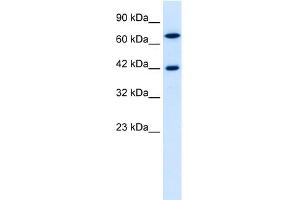 WB Suggested Anti-C20ORF100 Antibody Titration: 0. (TOX2 抗体  (N-Term))