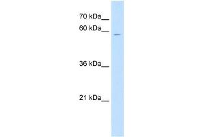 CSGALNACT1 antibody used at 1 ug/ml to detect target protein. (CSGALNACT1 抗体  (N-Term))