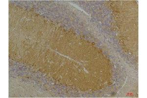 Immunohistochemical analysis of paraffin-embedded Rat BrainTissue using KCNN3(SK3) Rabbit pAb diluted at 1:200. (KCNN3 抗体)