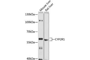Western blot analysis of extracts of various cell lines, using CYP2R1 antibody (ABIN6130162, ABIN6139341, ABIN6139342 and ABIN6214739) at 1:1000 dilution. (CYP2R1 抗体  (AA 252-501))