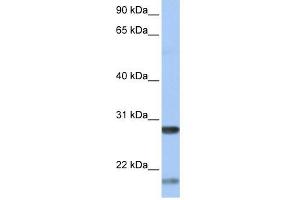BDNF antibody used at 1 ug/ml to detect target protein.