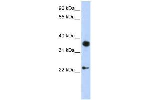 EN1 antibody used at 1 ug/ml to detect target protein. (EN1 抗体  (C-Term))