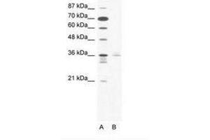 Image no. 1 for anti-LIM Homeobox 3 (LHX3) (AA 230-279) antibody (ABIN203106)