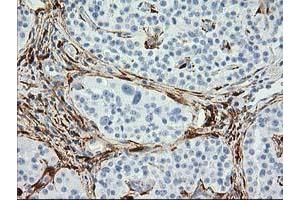 Image no. 4 for anti-Alcohol Dehydrogenase 1B (Class I), beta Polypeptide (ADH1B) antibody (ABIN1496479) (ADH1B 抗体)