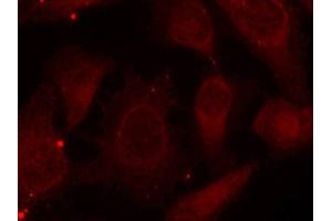Immunofluorescence staining of methanol-fixed Hela cells using Phospho-NF2-S518 antibody. (Merlin 抗体  (pSer518))