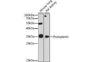Western blot analysis of extracts of various cell lines, using Podoplanin antibody (ABIN6128559, ABIN6145406, ABIN6145409 and ABIN6217196) at 1:1000 dilution. (Podoplanin 抗体)