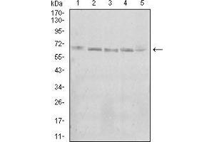 Western blot analysis using KBTBD8 mouse mAb against A431 (1), Jurkat (2), Hela (3), K562 (4), and HEK293 (5) cell lysate. (KBTBD8 抗体  (AA 264-464))