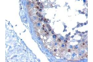 ABIN185184 (10µg/ml) staining of paraffin embedded Human Testis. (VPS28 抗体  (C-Term))