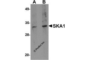 Western Blotting (WB) image for anti-Spindle and Kinetochore Associated Complex Subunit 1 (SKA1) (C-Term) antibody (ABIN1030667) (SKA1 抗体  (C-Term))