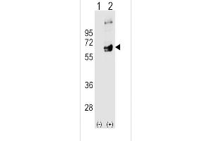 Western blot analysis of FYN using rabbit polyclonal FYN Antibody using 293 cell lysates (2 ug/lane) either nontransfected (Lane 1) or transiently transfected (Lane 2) with the FYN gene. (FYN 抗体  (N-Term))