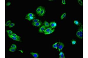 Immunofluorescent analysis of HepG2 cells using ABIN7176714 at dilution of 1:100 and Alexa Fluor 488-congugated AffiniPure Goat Anti-Rabbit IgG(H+L) (SLC39A8 抗体  (AA 30-132))