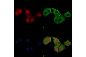 Phospho-IRF7 (Ser471/Ser472) Antibody staining Hela cells(heat shock treatment) by IF/ICC. (IRF7 抗体  (pSer471, pSer472))