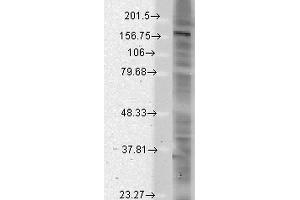 Western Blot analysis of Rat brain membrane lysate showing detection of SHANK protein using Mouse Anti-SHANK Monoclonal Antibody, Clone S23b-49 . (SHANK2 抗体  (AA 84-309) (Atto 594))