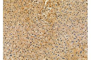 ABIN7094981 and ABIN7099037 at 1/100 staining mouse liver tissue by IHC-P. (ANKH 抗体)