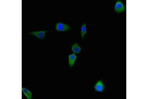 Immunofluorescent analysis of Hela cells using ABIN7148034 at dilution of 1:100 and Alexa Fluor 488-congugated AffiniPure Goat Anti-Rabbit IgG(H+L) (CBWD2 抗体  (AA 96-395))