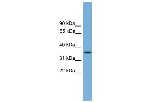 WB Suggested Anti-SPRY4 Antibody Titration:  0. (SPRY4 抗体  (Middle Region))