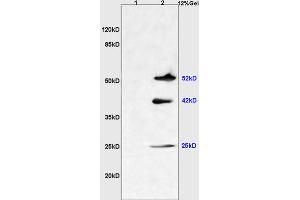 L1 mouse liver lysates L2 mouse brain lysates probed with Anti NGX6/C9orf127 Polyclonal Antibody, Unconjugated (ABIN737136) at 1:200 overnight at 4 °C. (TMEM8B 抗体  (AA 21-120))