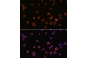 Immunofluorescence analysis of THP-1 cells using CTGF antibody (ABIN6127716, ABIN6139187, ABIN6139190 and ABIN6215053) at dilution of 1:100. (CTGF 抗体  (AA 27-349))