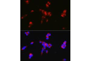 Immunofluorescence analysis of SH-SY5Y cells using D Rabbit pAb (ABIN6130242, ABIN6146067, ABIN6146068 and ABIN6219688) at dilution of 1:50 (40x lens).