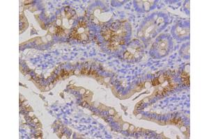 Paraformaldehyde-fixed, paraffin embedded Rat small intestine, Antigen retrieval by boiling in sodium citrate buffer (pH6) for 15min, Block endogenous peroxidase by 3% hydrogen peroxide for 30 minutes, Blocking buffer at 37°C for 20min, Antibody incubation with Cytokeratin 20 (1F10) Monoclonal Antibody  at 1:50 overnight at 4°C, followed by a conjugated secondary and DAB staining. (KRT20 抗体)