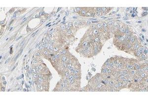 ABIN6279799 at 1/100 staining Human prostate tissue by IHC-P. (RIOK1 抗体  (C-Term))