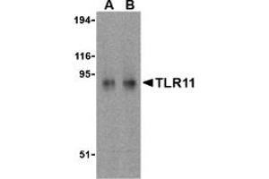 Image no. 2 for anti-Toll-Like Receptor 11 (Tlr11) (C-Term) antibody (ABIN204061) (TLR11 抗体  (C-Term))