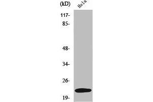 Western Blot analysis of K562 cells using UBE2T Polyclonal Antibody (Ube2t 抗体  (Internal Region))