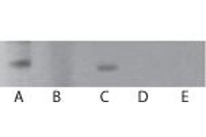 TLR7 Western Blot. (TLR7 抗体)