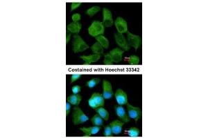 ICC/IF Image Immunofluorescence analysis of methanol-fixed A431, using TPP1, antibody at 1:200 dilution. (TPP1 抗体)