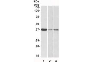 Western blot testing of human 1) liver, 2) skin and 3) tonsil lysate with IL12B antibody at 0. (IL12B 抗体)