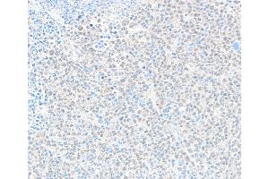 anti-Denticleless E3 Ubiquitin Protein Ligase Homolog (DTL) (C-Term) antibody