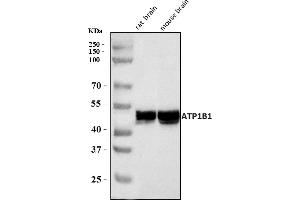 Western blot analysis of ATP1B1 using anti-ATP1B1 antibody (ABIN7602014).