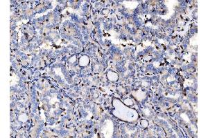 IHC analysis of EVL using anti-EVL antibody (ABIN7600986). (EVL 抗体  (AA 268-400))