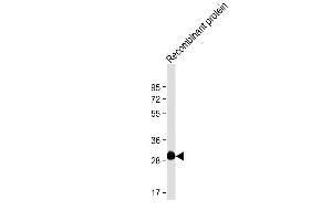 Anti-ROS1 Antibody at 1:4000 dilution + Recombinant protein Lysates/proteins at 20 ng per lane. (ROS1 抗体)