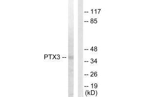 Western blot analysis of extracts from 293 cells, using PTX3 antibody. (PTX3 抗体  (N-Term))