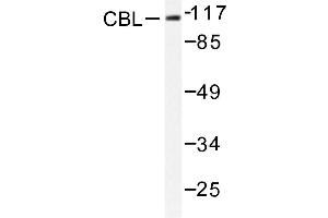 Image no. 1 for anti-Cas-Br-M (Murine) Ecotropic Retroviral Transforming Sequence (CBL) antibody (ABIN272004) (CBL 抗体)
