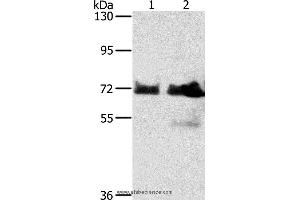 Western blot analysis of Hela and Raji cell, using BRAF Polyclonal Antibody at dilution of 1:400 (BRAF 抗体)