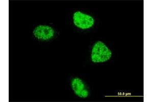 Immunofluorescence of monoclonal antibody to ZBTB33 on HeLa cell. (ZBTB33 抗体  (AA 564-673))