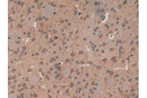 IHC-P analysis of Mouse Brain Tissue, with DAB staining. (MAP1A 抗体  (AA 2552-2759))