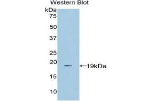Western Blotting (WB) image for anti-Farnesyl-Diphosphate Farnesyltransferase 1 (FDFT1) (AA 269-417) antibody (ABIN3206188) (FDFT1 抗体  (AA 269-417))