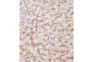 Immunohistochemical analysis of (ABIN655236 and ABIN2844840) on paraffin-embedded human liver tissue was performed on the Leica®BOND RXm.