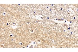 Immunohistochemistry (IHC) image for anti-Transmembrane Protease, serine 2 (TMPRSS2) (AA 284-492) antibody (ABIN7435142)