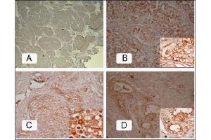 Immunohistochemistry (IHC) image for anti-Folate Hydrolase (Prostate-Specific Membrane Antigen) 1 (FOLH1) antibody (ABIN452578) (PSMA 抗体)