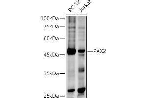 Western blot analysis of extracts of various cell lines, using P antibody (ABIN3017304, ABIN3017305, ABIN1681265 and ABIN6220029) at 1:500 dilution. (PAX2A 抗体)